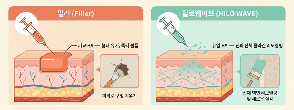 Apgujeong HiloWave 填充剂和 HiloWave 重塑双 HA 胶原蛋白的区别比较信息图表 - 填充剂填充体积,HiloWave 重塑双 HA 胶原蛋白