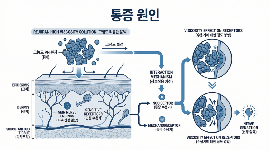 리쥬란 통증의 원인인 고점도 PN 성분과 pH 차이를 설명하는 의학 인포그래픽