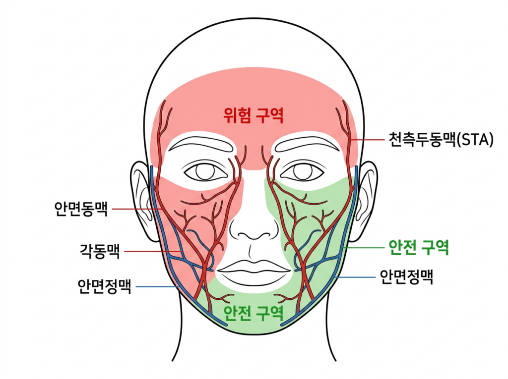 面部血管解剖以防止 Ulthera 副作用 血管损伤 - 面部动脉 - 角动脉 - 颞动脉位置图