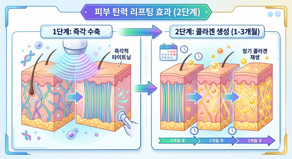 올타이트 통증은 적지만 효과는 강력한 2단계 콜라겐 재생 과정 