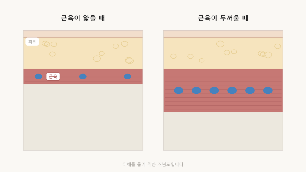 보톡스 가격, 몇 cc가 아니라 몇 유닛인지 보세요 근육이 얇을 때와 두꺼울 때 같은 부위에 들어가야 하는 보톡스 양이 다르다는 것을 나타낸 피부·근육 단면 개념도