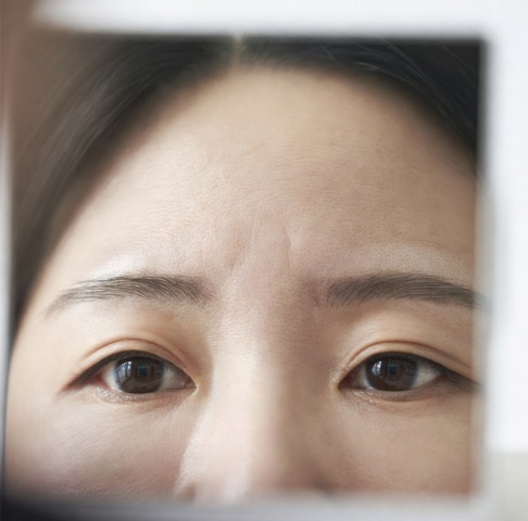 눈꺼풀 처짐 없이 안전한 시술을 위한 이마 주름 보톡스부위추천 가이드 이미지
