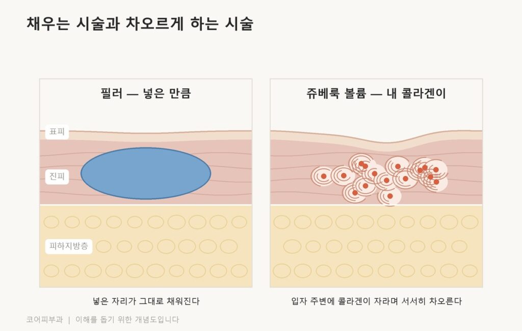 쥬베룩 볼륨 효과, 후기가 극과 극인 이유는? 필러는 넣은 자리가 그대로 차오르고 쥬베룩 볼륨은 콜라겐이 자라며 차오르는 차이를 비교한 피부 단면도